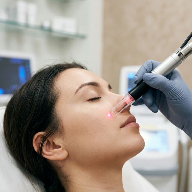 İğneli Lazer Epilasyon